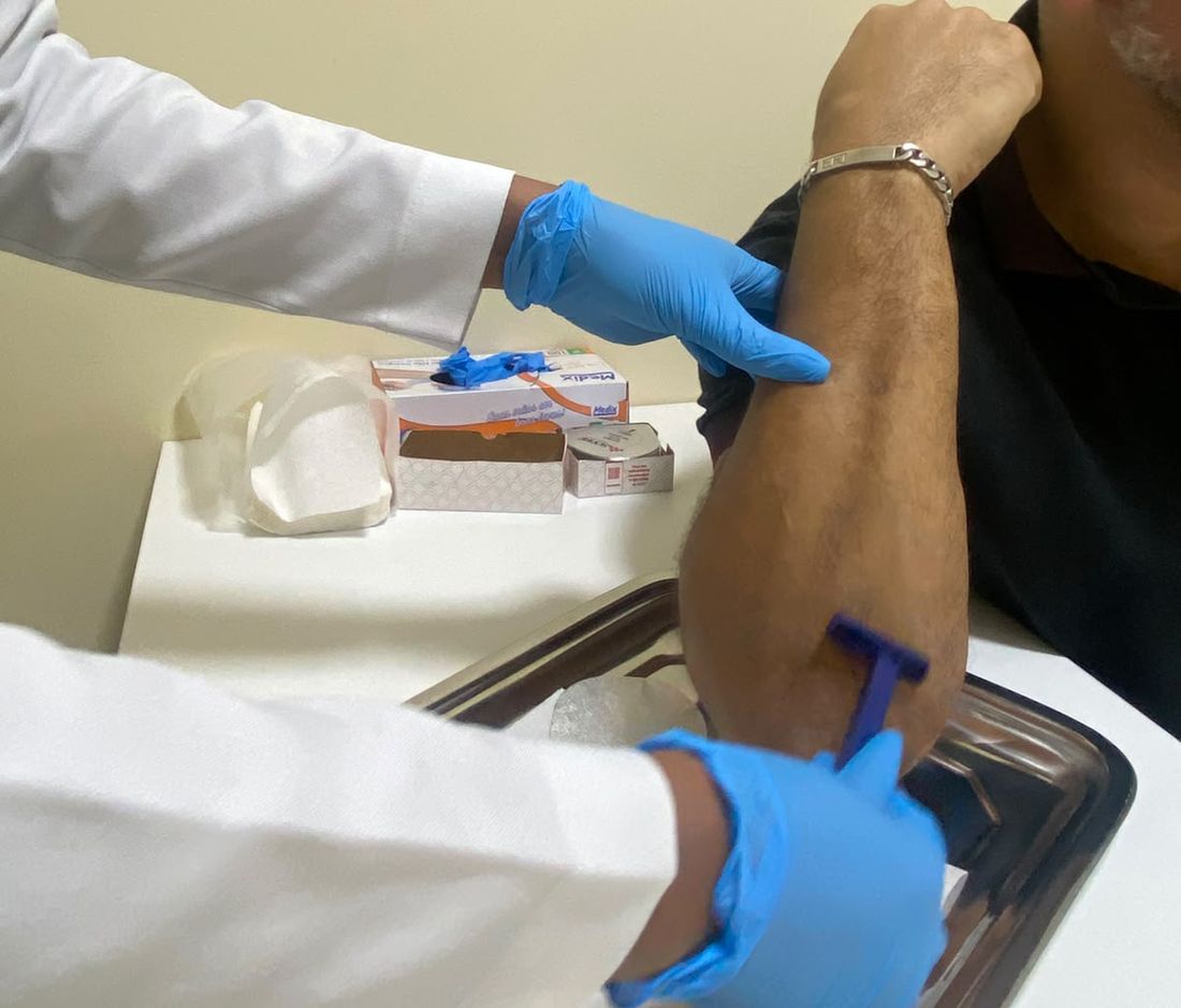 Profissional de jaleco e luvas fazendo a coleta de pelo do braço para o exame toxicológico